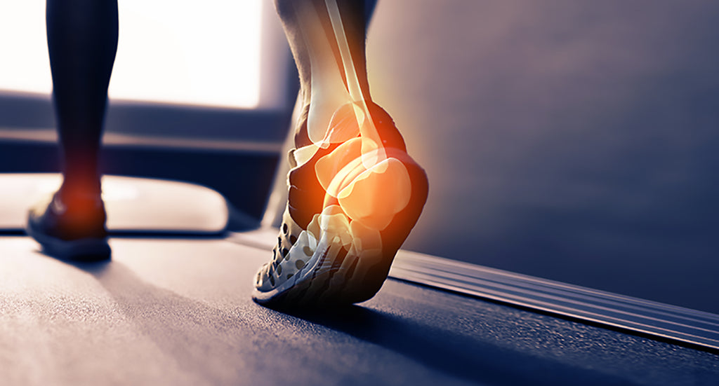 Pain in your heels? It could be Plantar Fasciitis.